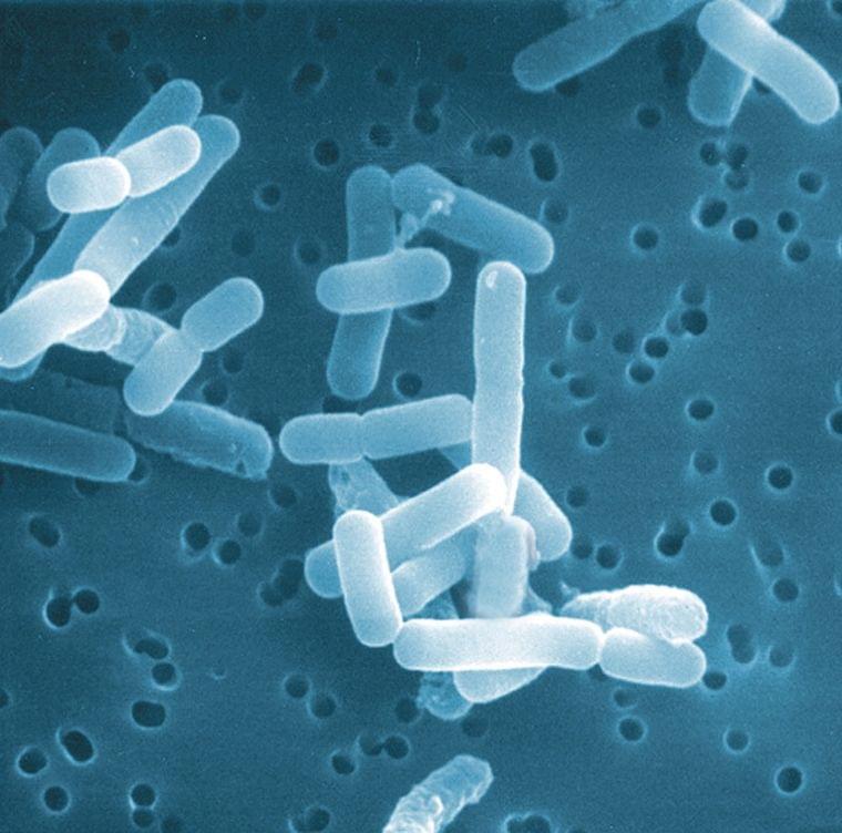 腸の健康は口から? 欧米で“バクテリアセラピー”が話題!