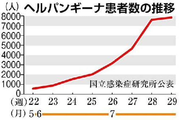 夏風邪「ヘルパンギーナ」流行 山形、新潟、静岡で「警報レベル」 - SankeiBiz(サンケイビズ)