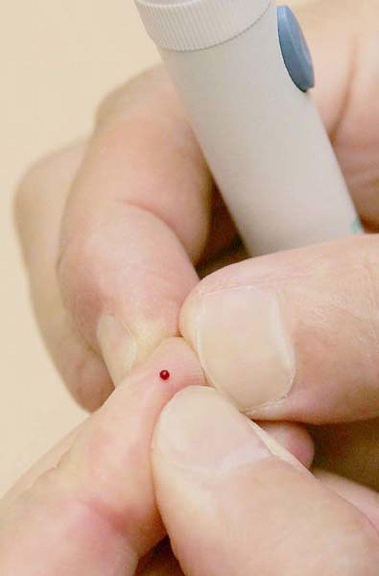 【糖尿病】食後に眠くて…ブドウ糖負荷試験で“隠れ糖尿病”を見破る｜日刊ゲンダイヘルスケア