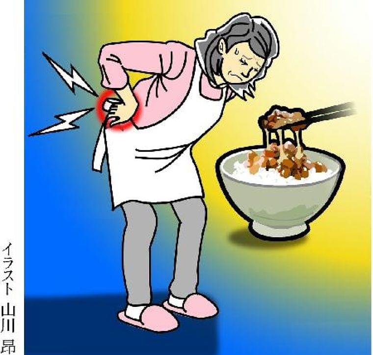 【痛み学入門講座】骨粗鬆症対策は納豆食べて日光浴  (1/2ページ) - SankeiBiz（サンケイビズ）