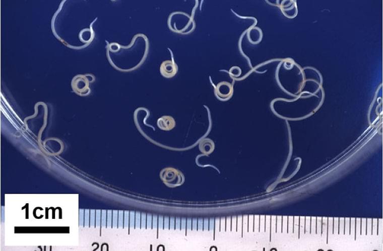 アニサキス食中毒、2年で3.7倍 食安委など実態把握へ