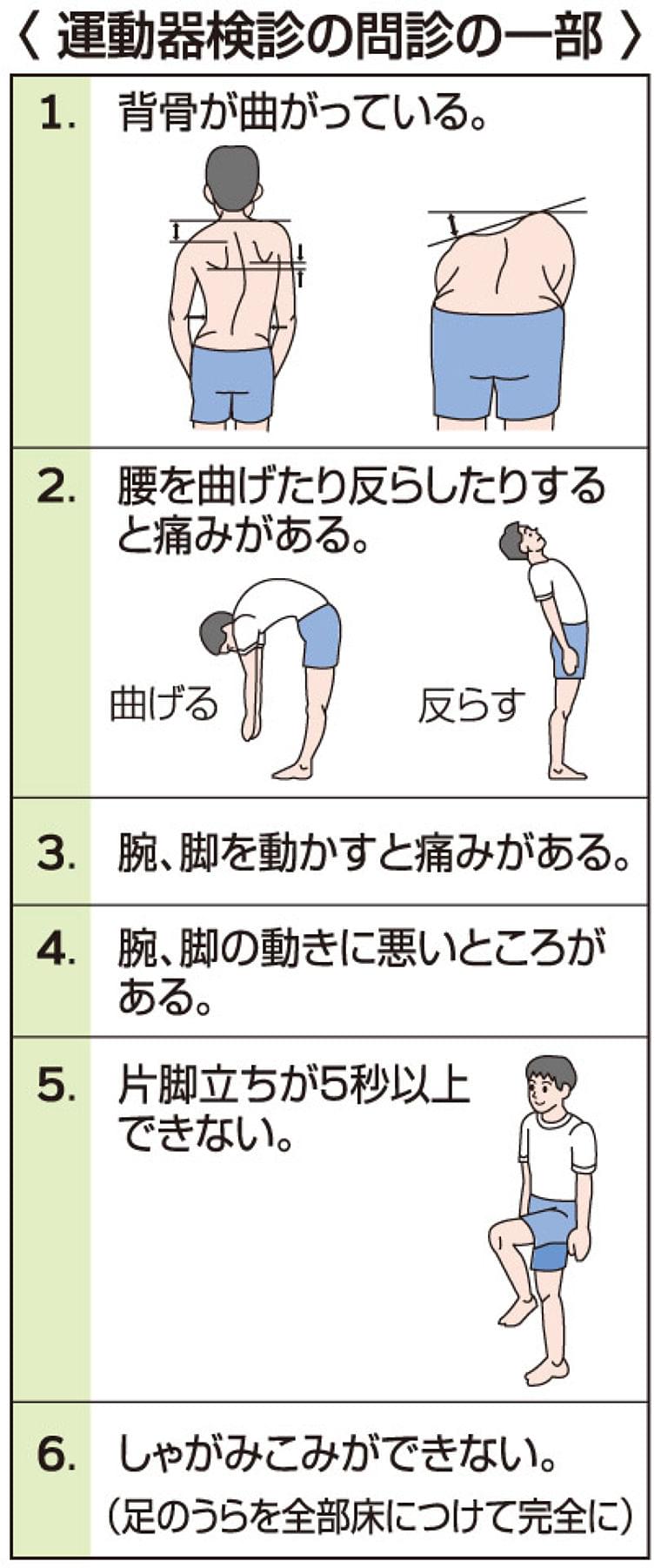 子どもの運動器検診 | 岐阜新聞Web