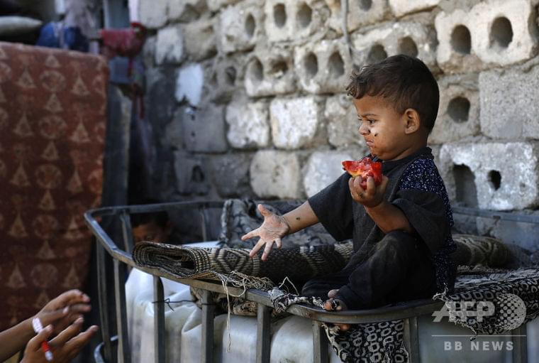 5歳未満の子ども、3人に1人が栄養不良か過体重 ユニセフ 写真1枚 国際ニュース:AFPBB News