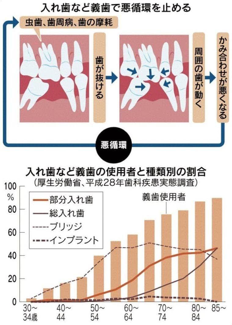 入れ歯でも口を健康に 歯の数少ないと高い介護リスク(NIKKEI STYLE) - Yahoo!ニュース