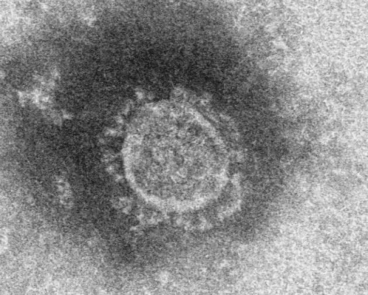 新型コロナ:緊急性高い症状注意を 厚労省が12項目公表 (写真=共同) :日本経済新聞