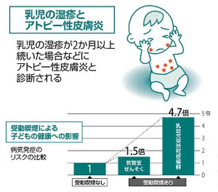 たばことアトピー性皮膚炎 妊娠中 赤ちゃんに影響 Yomidr ヨミドクター 読売新聞 ニュース Eatreat