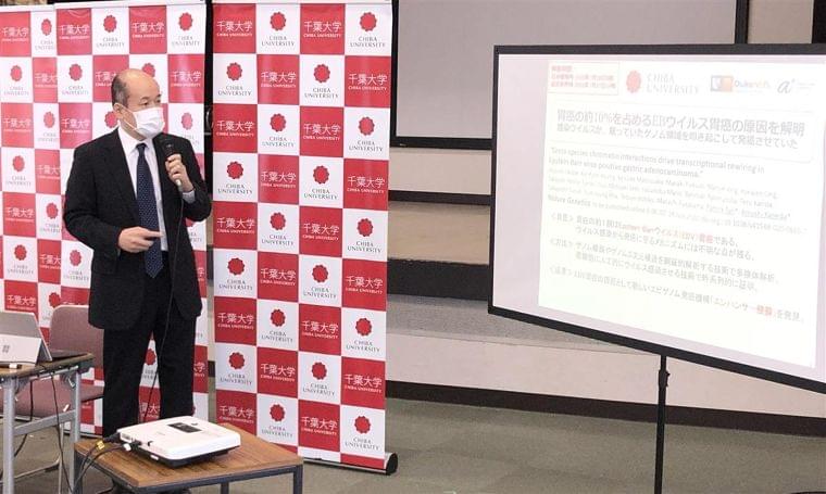 ウイルス胃がんの仕組み解明 千葉大など 治療法確立に期待:イザ!