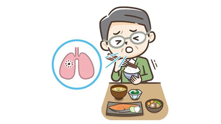 50代でも喉は高齢者かも… 周囲の筋肉を鍛え、誤嚥を防ぐトレーニングを : yomiDr./ヨミドクター(読売新聞)