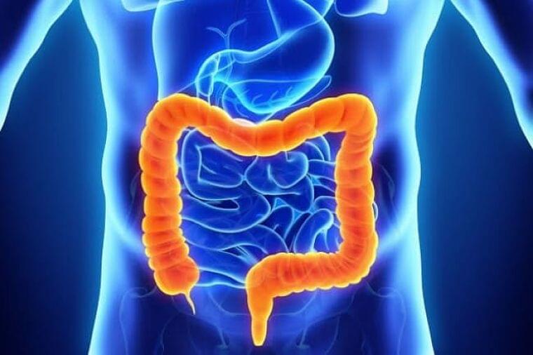 増えている大腸がん 早期発見で5年生存率は意外に…