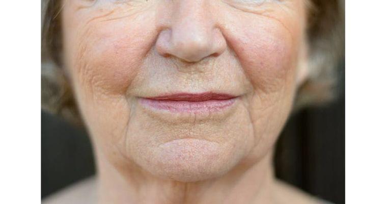 見過ごしがち 認知症患者の「お口トラブル」|ヘルスUP|NIKKEI STYLE