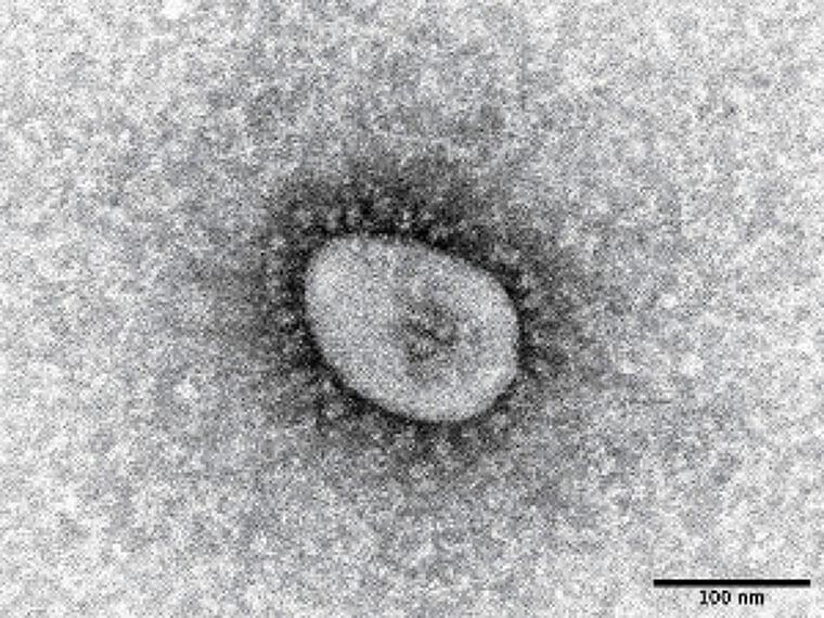 「梅干しにコロナウイルスの増殖抑える効果」、サル由来の細胞で効果確認 | ヨミドクター(読売新聞)