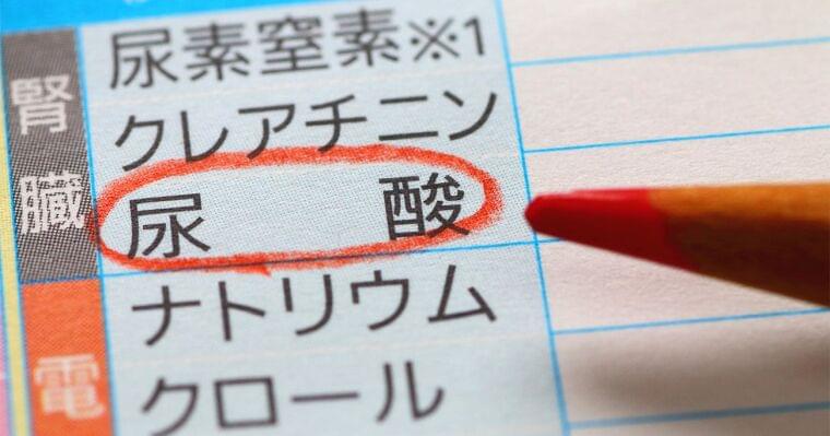 健康診断で「痛風予備軍です」、結果表の見方と尿酸値改善5つのポイント | ストレスフリーな食事健康術 岡田明子 | ダイヤモンド・オンライン