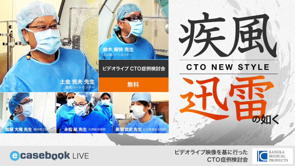Video 疾風迅雷の如く Cto New Style 循環器内科 E Casebook Live