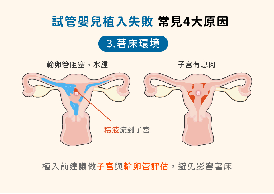 试管婴儿植入失败，原因著床环境