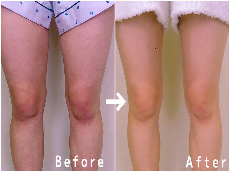 21最新 人気着圧レギンス15選を徹底比較 おすすめは 効果や口コミもご紹介します