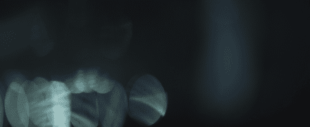 AnomalylensSet-Bokeh-4