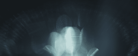 AnomalylensSet-Bokeh-6