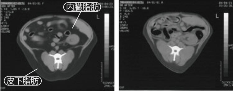肥満犬(左)と適正体重の犬(右)のCT画像