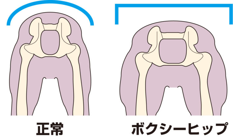 ボクシー・ヒップになる