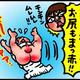 【子育て絵日記4コママンガ】つるちゃんの里帰り｜（58）オムツかぶれで真っ赤っか（0歳0ヶ月頃）
