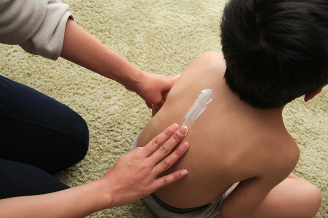 塗り薬を塗る男の子,子供,とびひ,