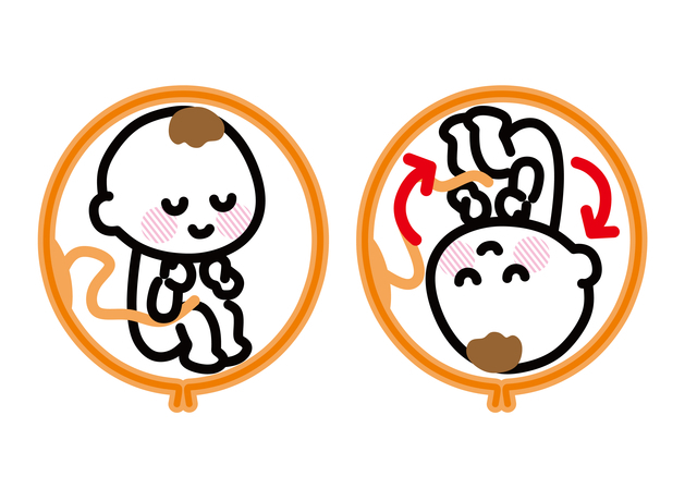 一般的な状態と逆子の赤ちゃん,逆子,いつまで,