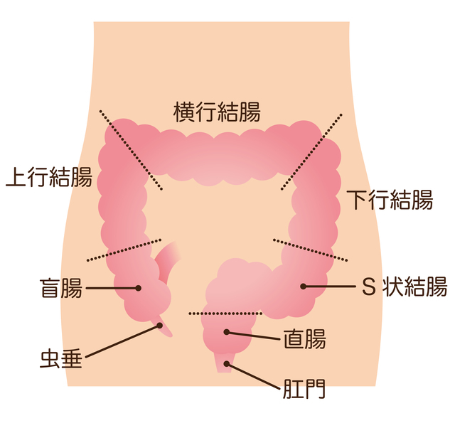 虫垂の場所,虫垂炎,盲腸,子ども