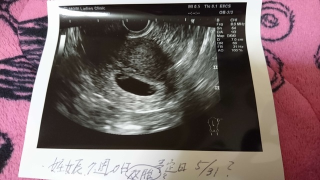 エコー写真 7週0日 7w0d 男の子,妊娠,7週,