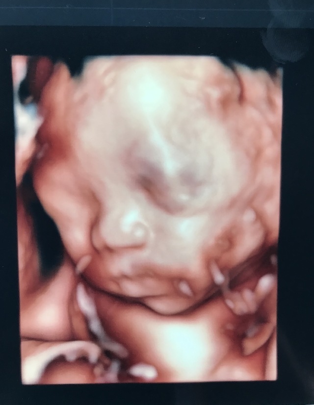エコー写真 25週3日 25w3d 男の子,妊娠,25週,エコー写真