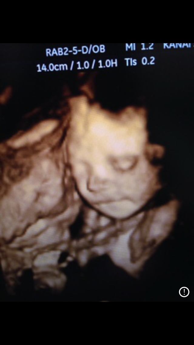 エコー写真 26週3日 26w3d 男の子,妊娠26週,エコー,
