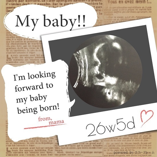 エコー写真 26週5日 26w5d 男の子,妊娠26週,エコー,