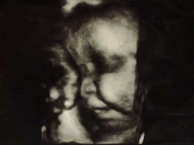 エコー写真 27週0日 27w0d 女の子,妊娠,27週,エコー写真