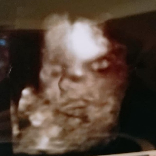 エコー写真 27週4日 27w4d 女の子,妊娠,27週,エコー写真
