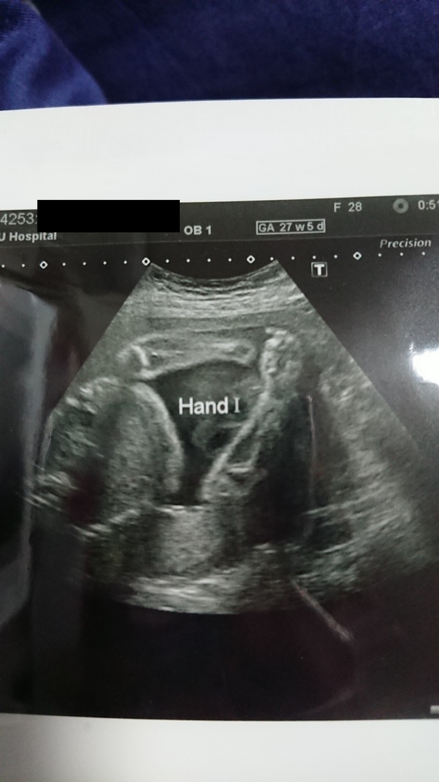 エコー写真 27週6日 27w6d 女の子,妊娠,27週,エコー写真