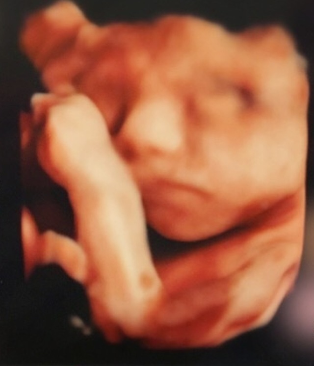 エコー写真 27週6日 27w6d 男の子,妊娠,27週,エコー写真