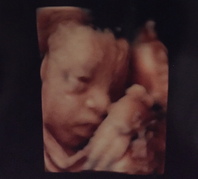 エコー写真 28週1日 28w1d 女の子,妊娠28週,エコー,