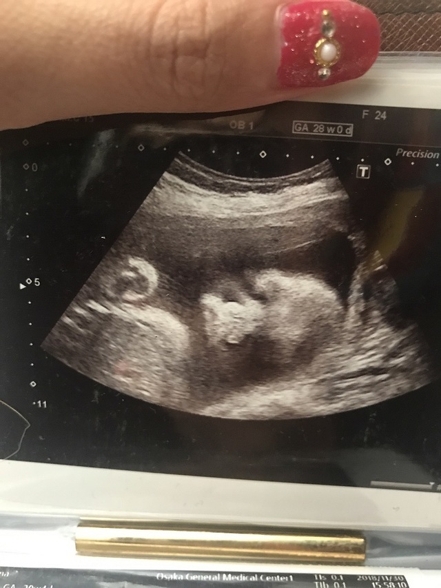 エコー写真 28週1日 28w1d 男の子,妊娠28週,エコー,