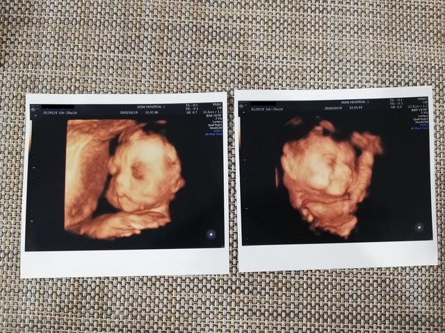 エコー写真 28週2日 28w2d 男の子,妊娠28週,エコー,
