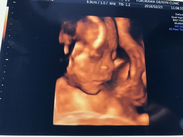 エコー写真 28週4日 28w4d 男の子,妊娠28週,エコー,