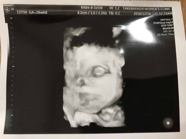 エコー写真 28週6日 28w6d 女の子,妊娠28週,エコー,