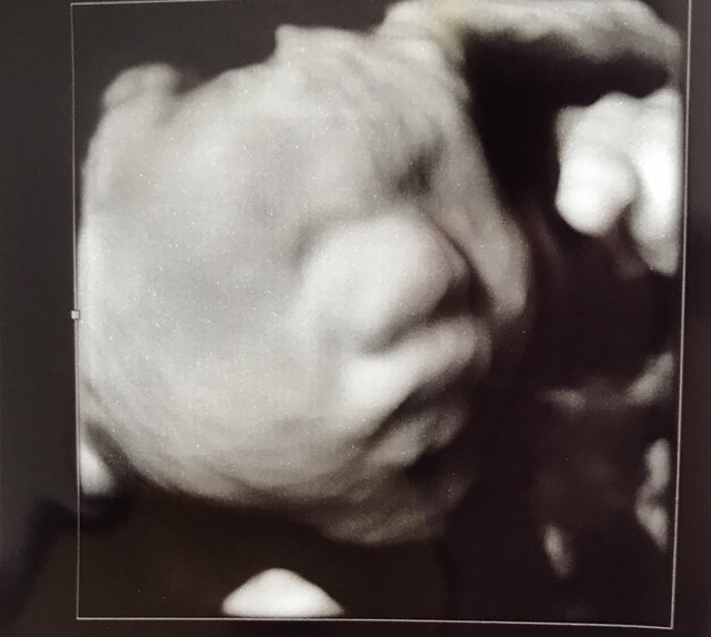 エコー写真 29週4日 29w4d 男の子,妊娠29週,エコー,