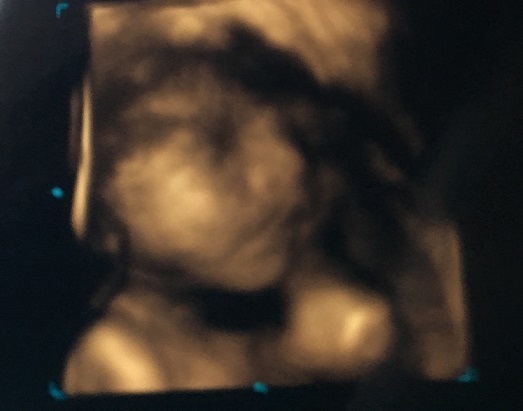 エコー写真 29週4日 29w4d 男の子,妊娠29週,エコー,