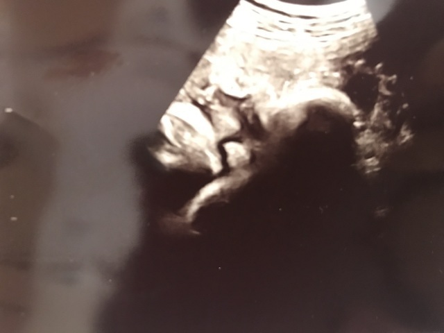 エコー写真 36週4日 36w4d 男の子,妊娠36週,エコー,