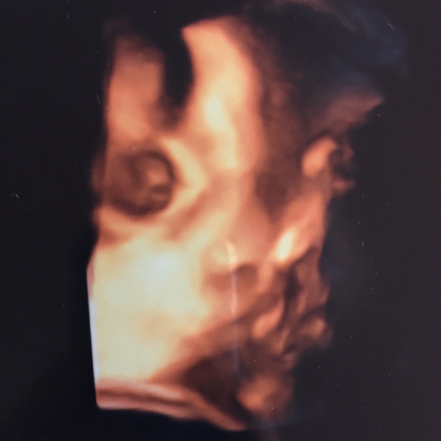 エコー写真 36週4日 36w4d 女の子,妊娠36週,エコー,