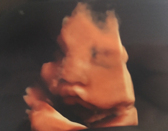 37週5日 37w5d 男の子,妊娠37週,エコー,