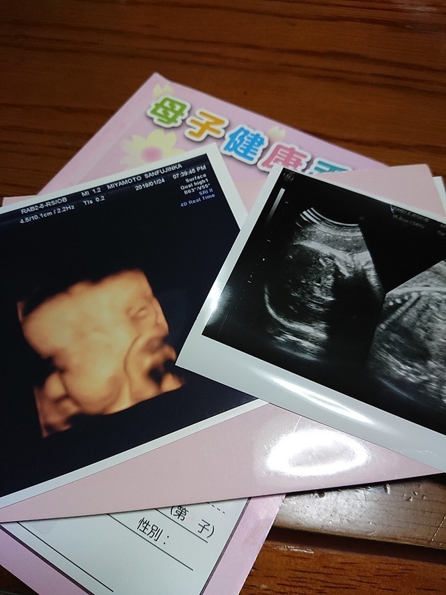 37週6日 37w6d 女の子,妊娠37週,エコー,