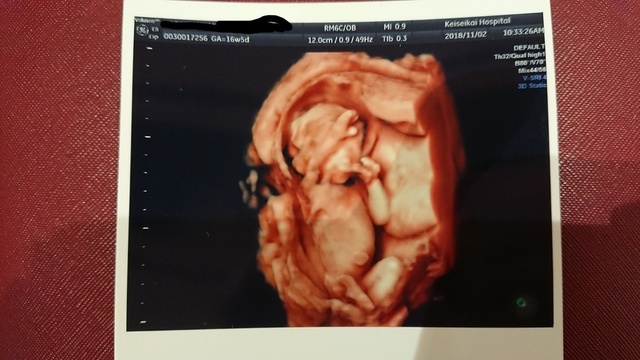 エコー写真 16週4日 16w4d 女の子,妊娠16週,エコー写真,