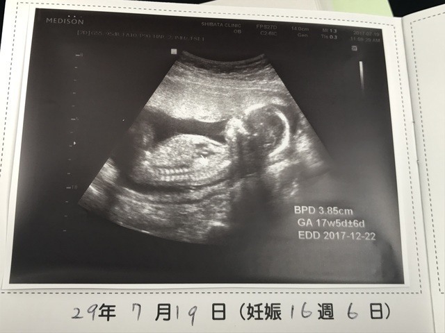 エコー写真 16週5日 16w5d 性別不明,妊娠16週,エコー写真,