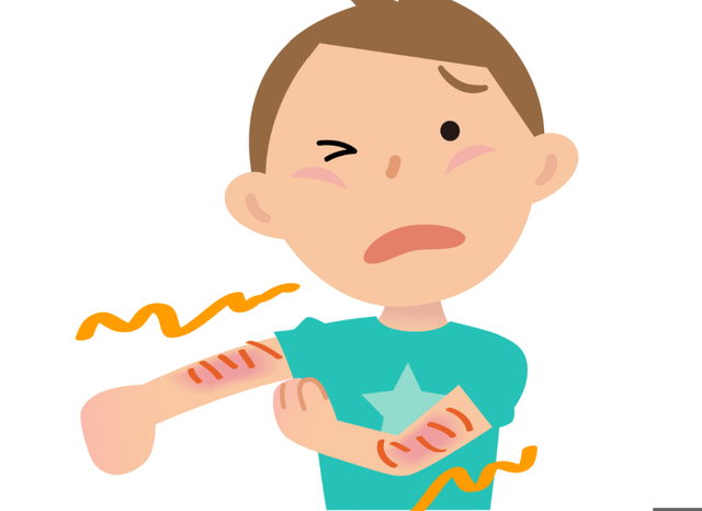 ヒリヒリ肌,キッズパジャマ,男の子,おすすめ