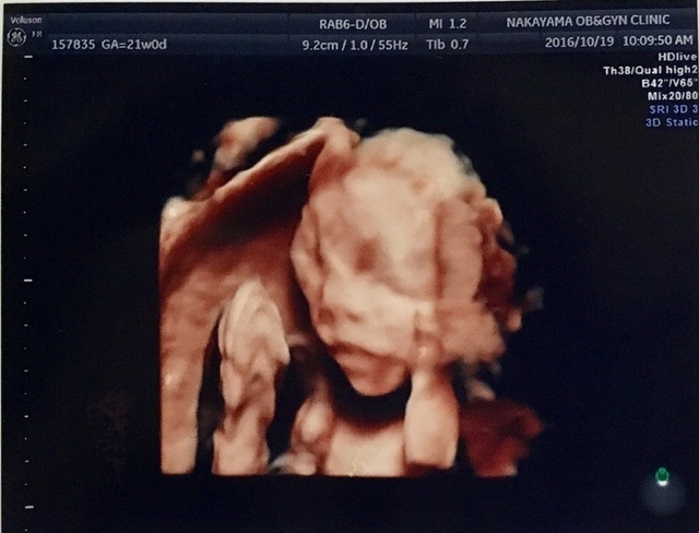 エコー写真 21週0日 21w0d 女の子,妊娠21週,エコー,